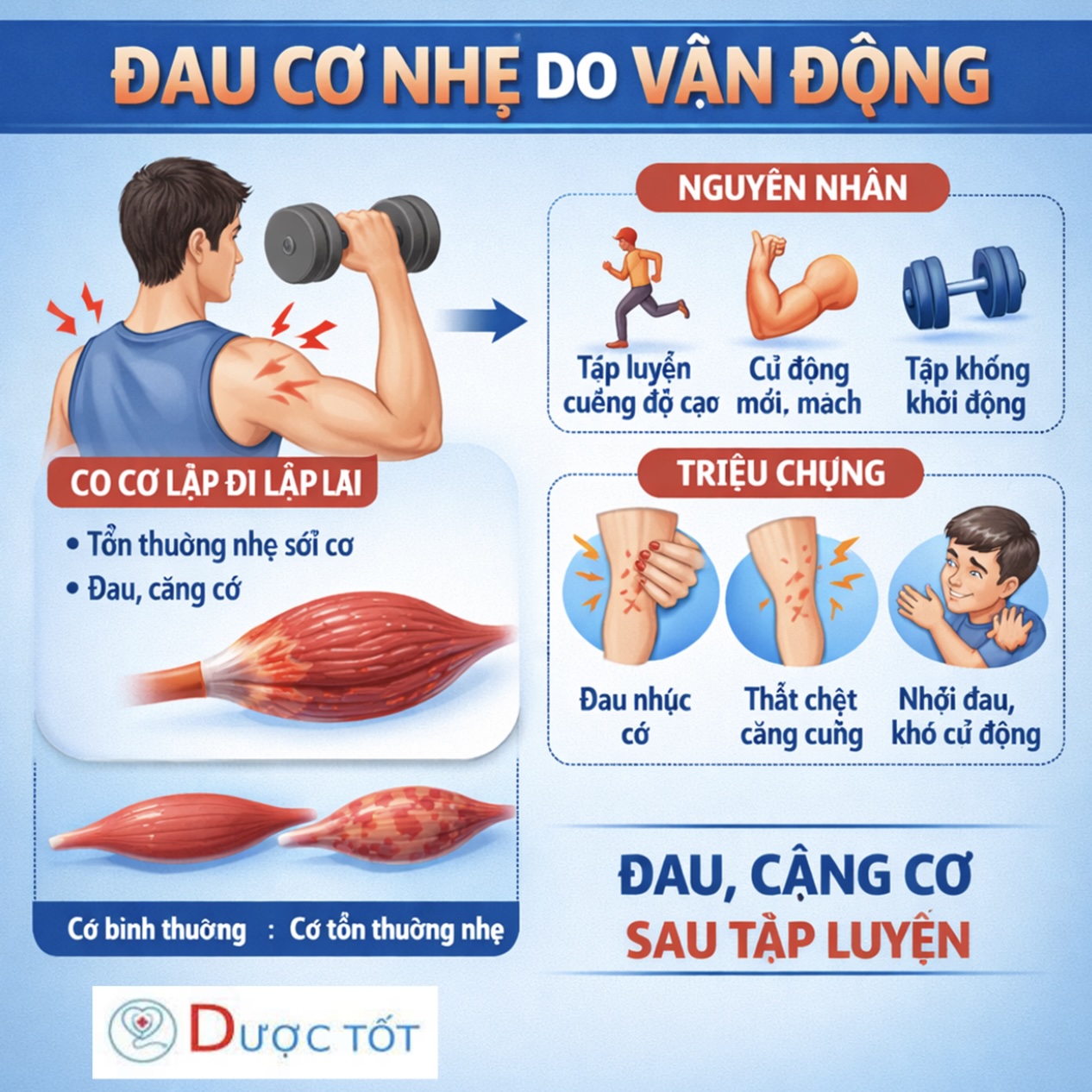 ĐAU CƠ NHẸ SAU VẬN ĐỘNG – XỬ LÝ THẾ NÀO?