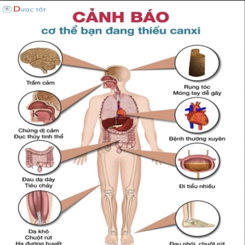 THIẾU CANXI – NGUYÊN NHÂN ÂM THẦM GÂY ĐAU NHỨC