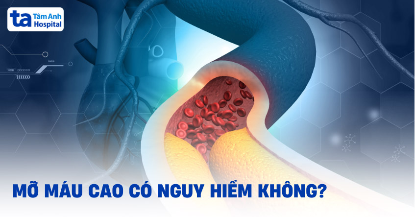 Bệnh Alzheimer – Khi trí nhớ dần phai ở tuổi già