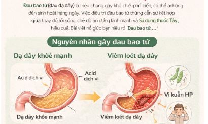 Liều thuốc tây đau bao tử (đau dạ dày)