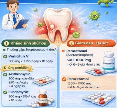 Liều thuốc giúp điều trị Viêm họng do vi khuẩn 
