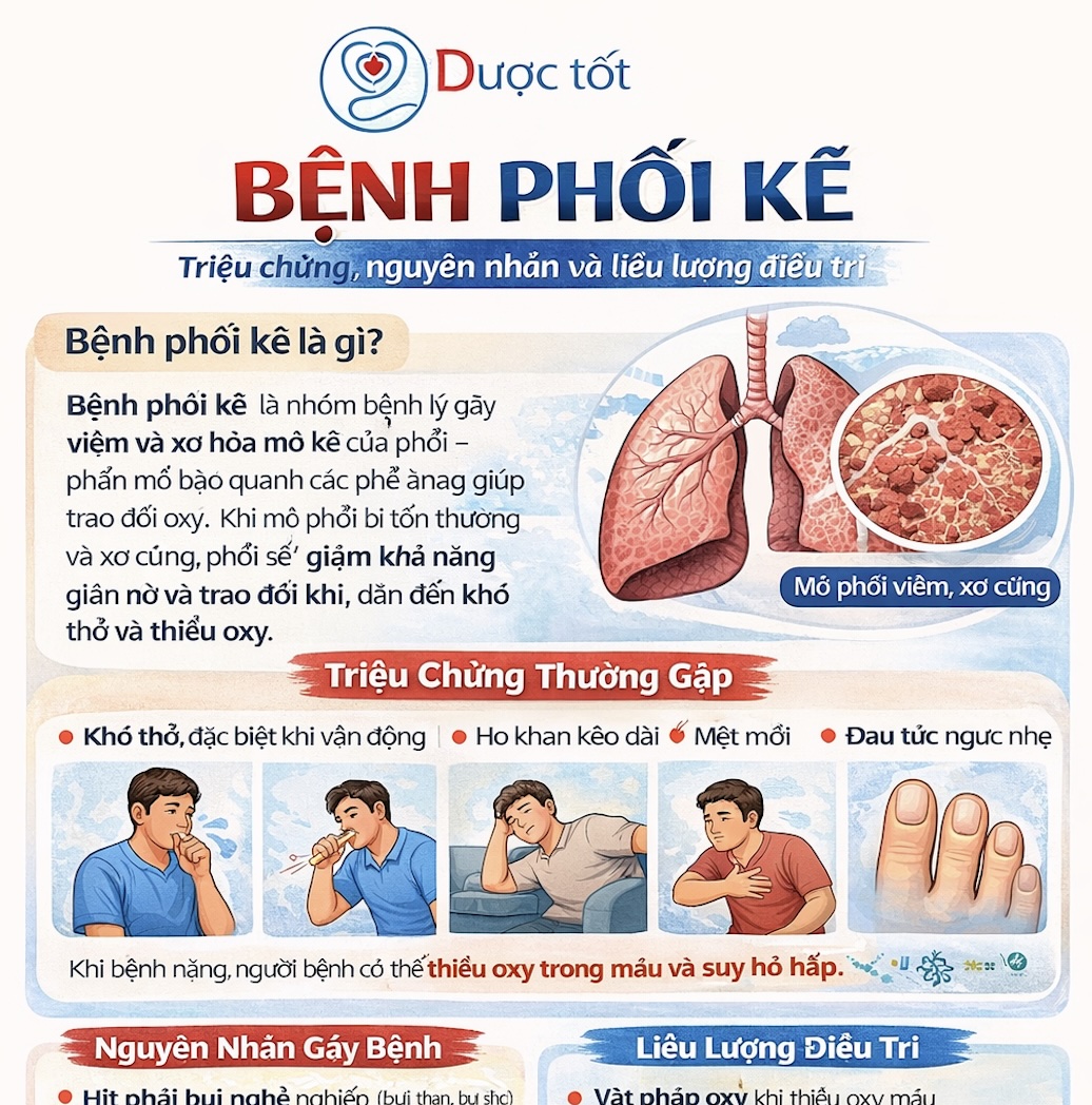 Interstitial Lung Disease (bệnh phổi kẽ) & Cách điều trị