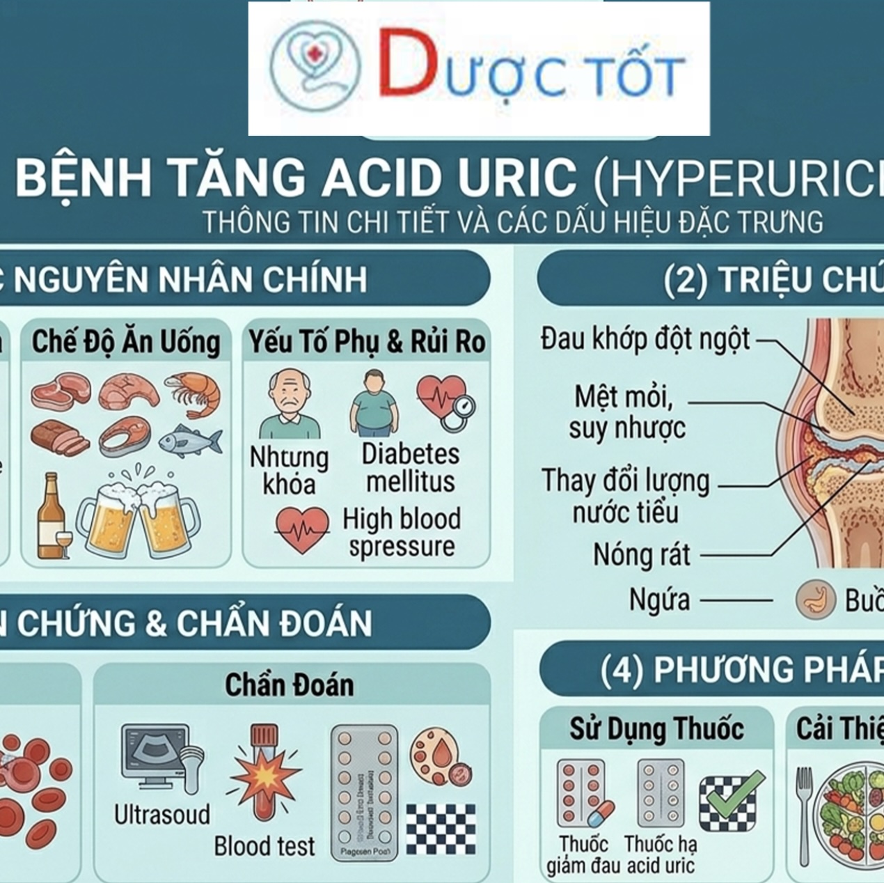 TĂNG ACID URIC (GOUT) – KIỂM SOÁT ĐÚNG ĐỂ BẢO VỆ THẬN 