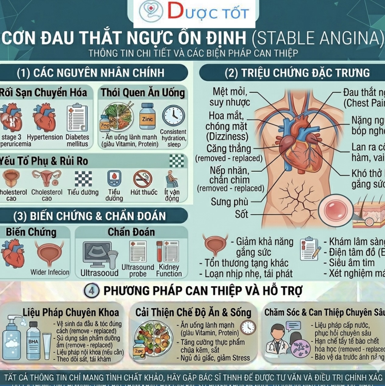 ĐAU THẮT NGỰC ỔN ĐỊNH – DÙNG THUỐC GÌ?