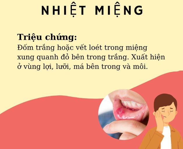 Liều thuốc Tây điều trị nhiệt miệng (tham khảo)