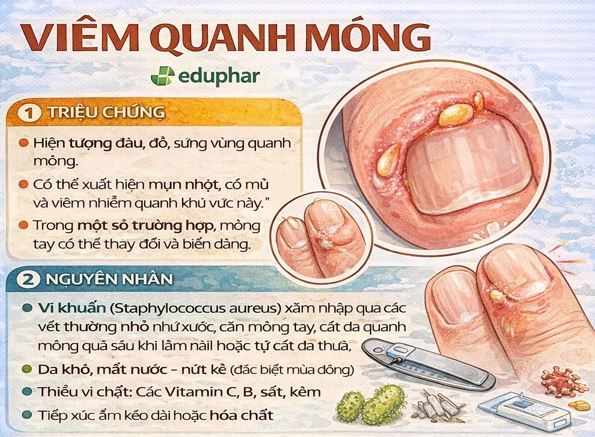 Liều thuốc điều trị Viêm quanh móng và cách phòng ngừa