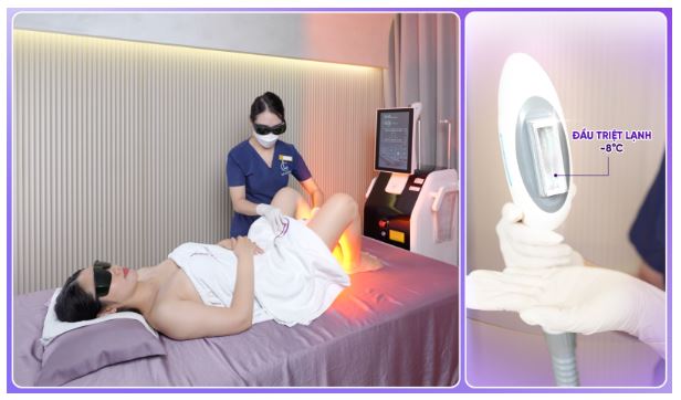 Review công nghệ triệt lông bikini tại LG Clinic có hiệu quả không?