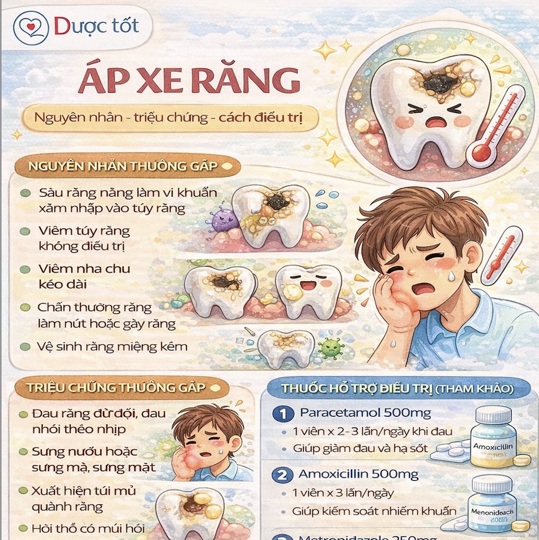 Áp xe răng và cách điều trị