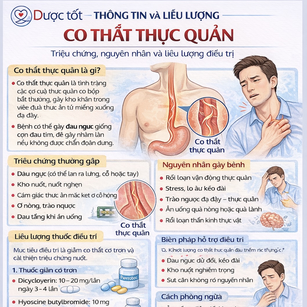 Điều trị Esophageal Spasm (co thắt thực quản) 