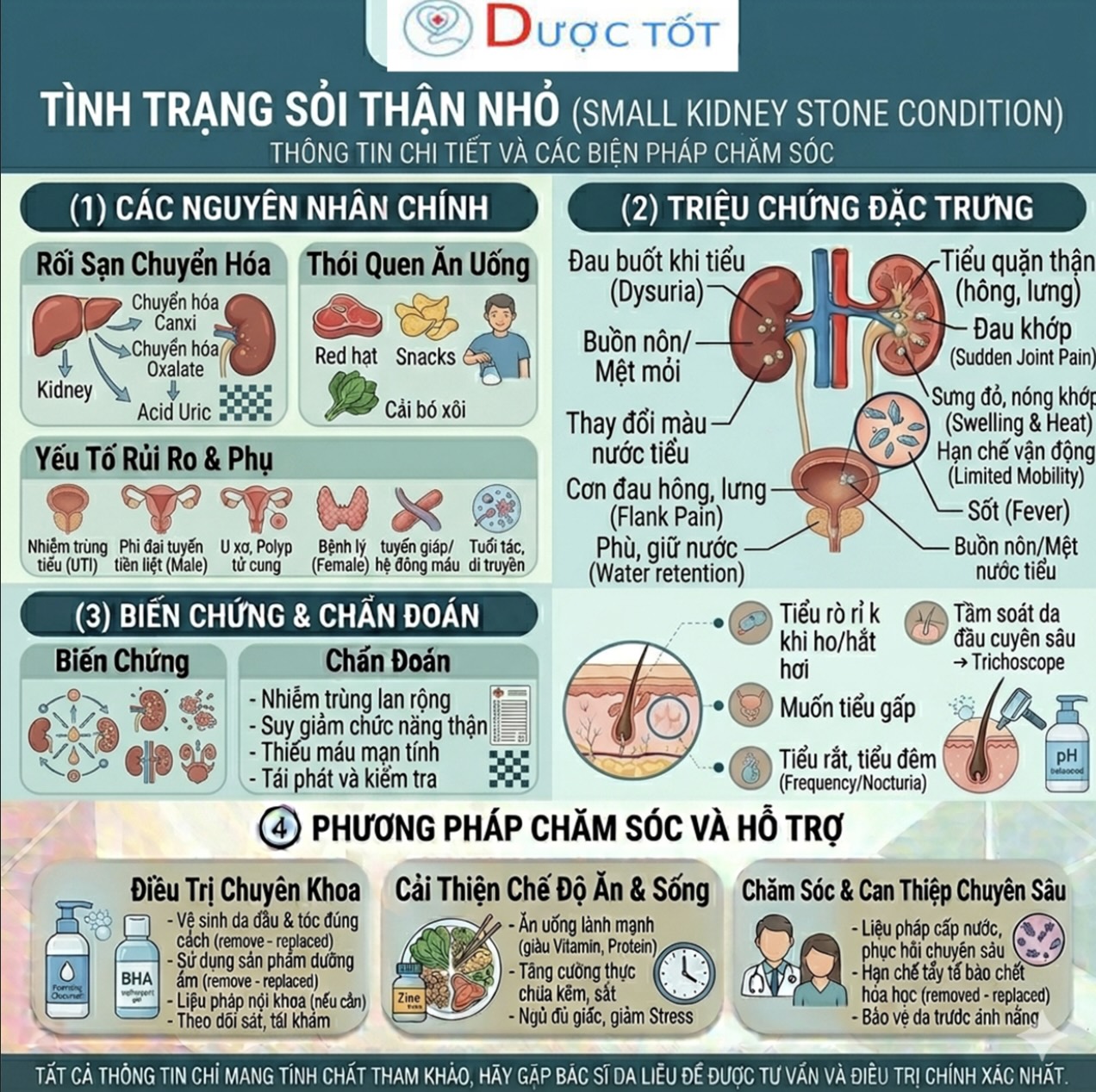 TÌNH TRẠNG SỎI THẬN NHỎ (<5mm) & CÁCH ĐIỀU TRỊ
